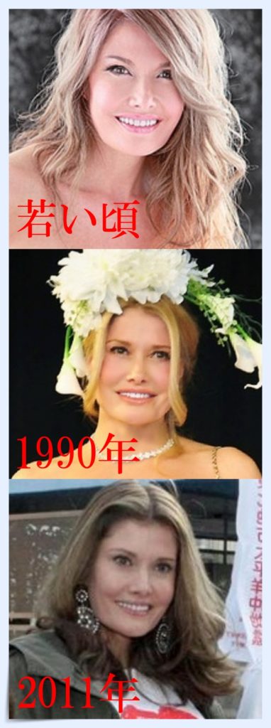 カイヤの顔が変わった【画像】若い頃から時系列で比較!唇は整形か?